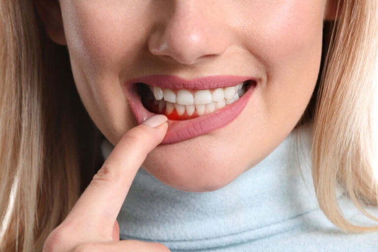 What Can Cause Gum Pain? Austin Restorative Dentistry