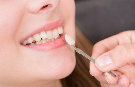 Dentist placing a dental veneer between teeth