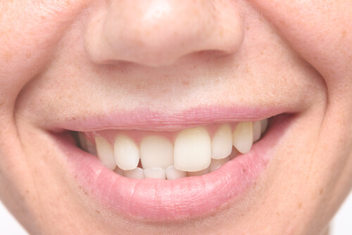 Man adult with crooked teeth