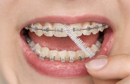 Person flossing teeth with braces
