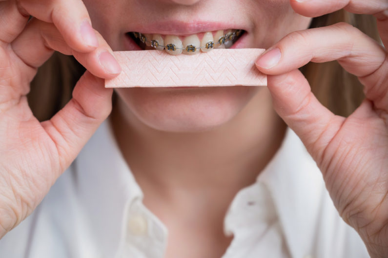 Person with braces eating gum