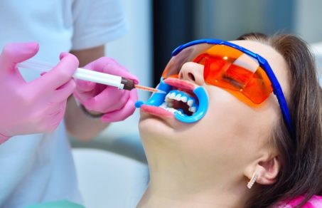 Person getting teeth whiten at professional teeth whitening dentist Austin