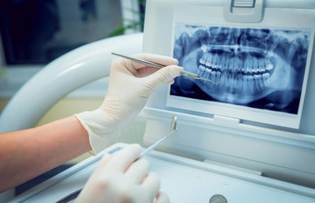 Woman at the dentist going over her digital imagery to decide which will be best procedure for her restorative dentistry