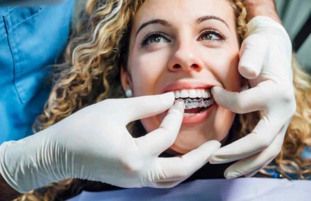 Woman having Invisalign placed on her top teeth for her cross bite