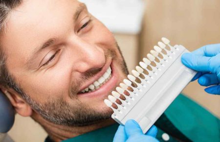 Man getting checked by the dentist testing different colors of porcelain veneers